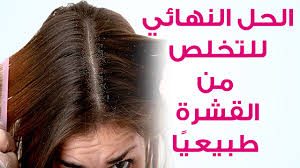 تعرف على العلاج الأفضل والوصفات الطبيعية للقضاء على قشرة الشعر